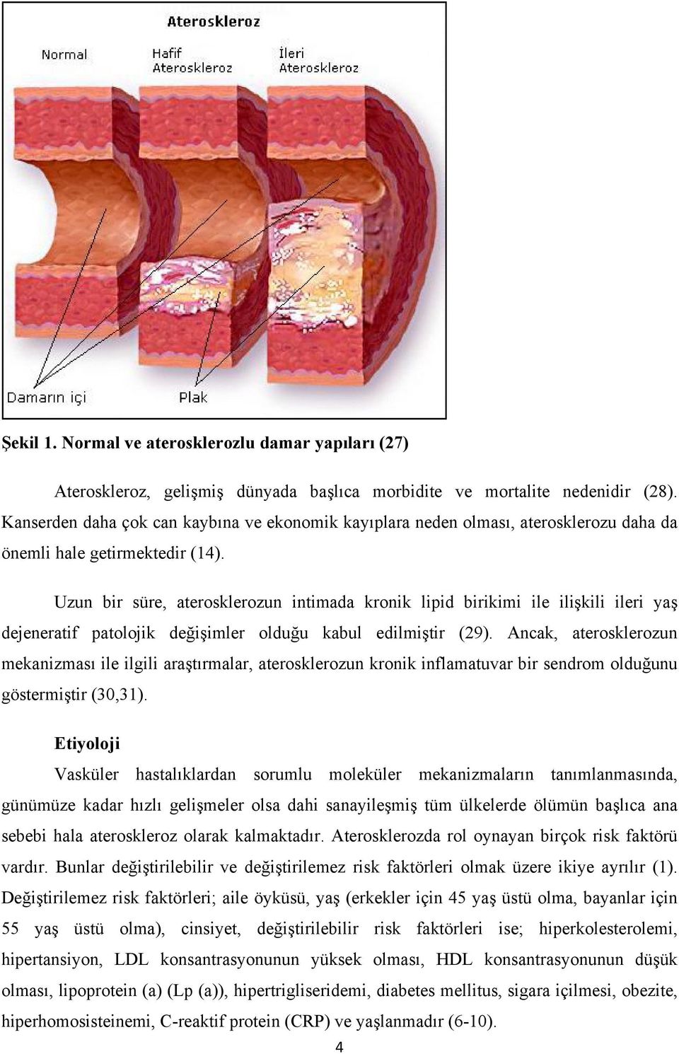 Uzun bir süre, aterosklerozun intimada kronik lipid birikimi ile ilişkili ileri yaş dejeneratif patolojik değişimler olduğu kabul edilmiştir (29).