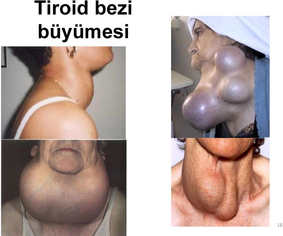 büyümesi