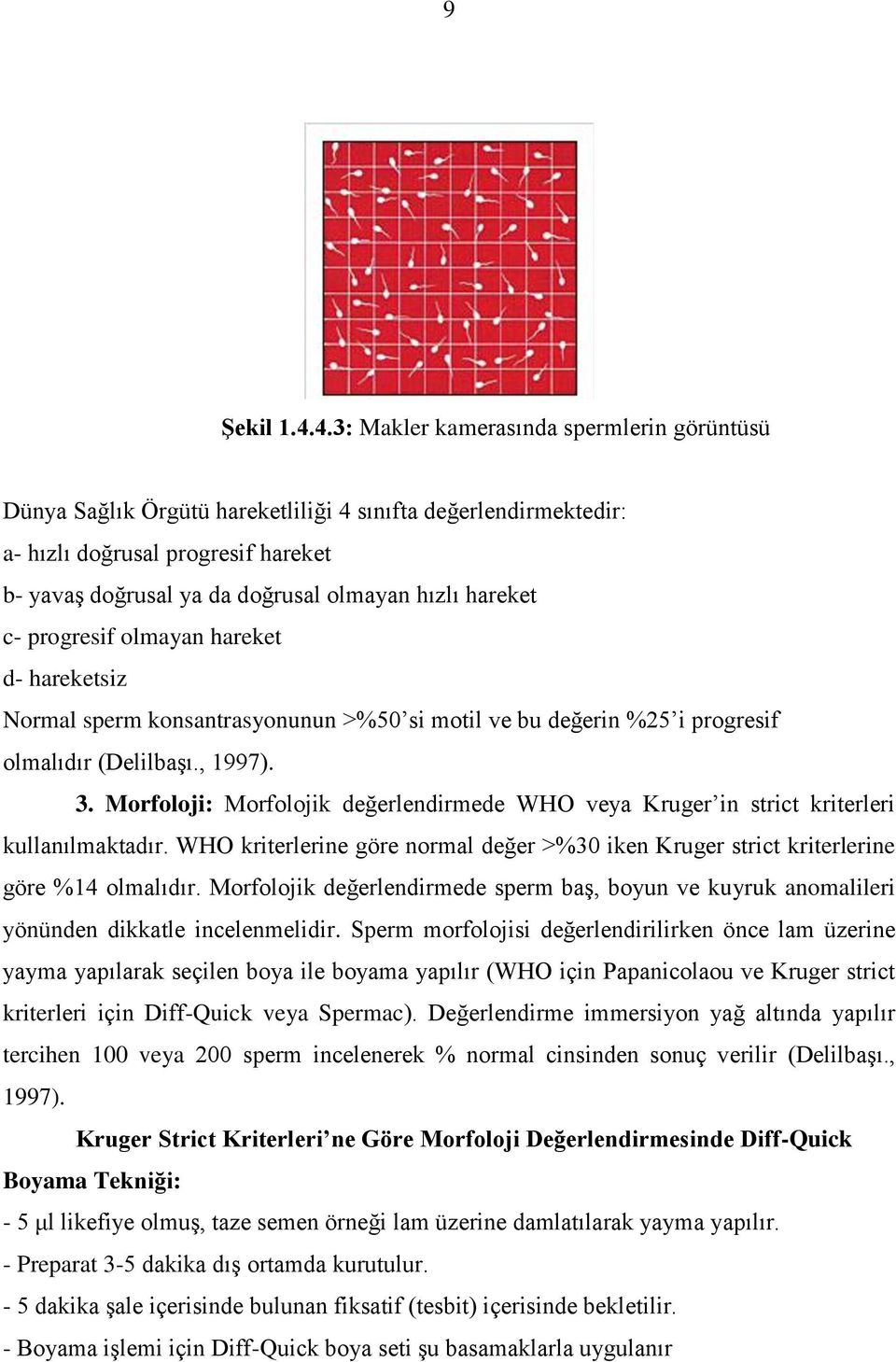 hareket c- progresif olmayan hareket d- hareketsiz Normal sperm konsantrasyonunun >%50 si motil ve bu değerin %25 i progresif olmalıdır (Delilbaşı., 1997). 3.