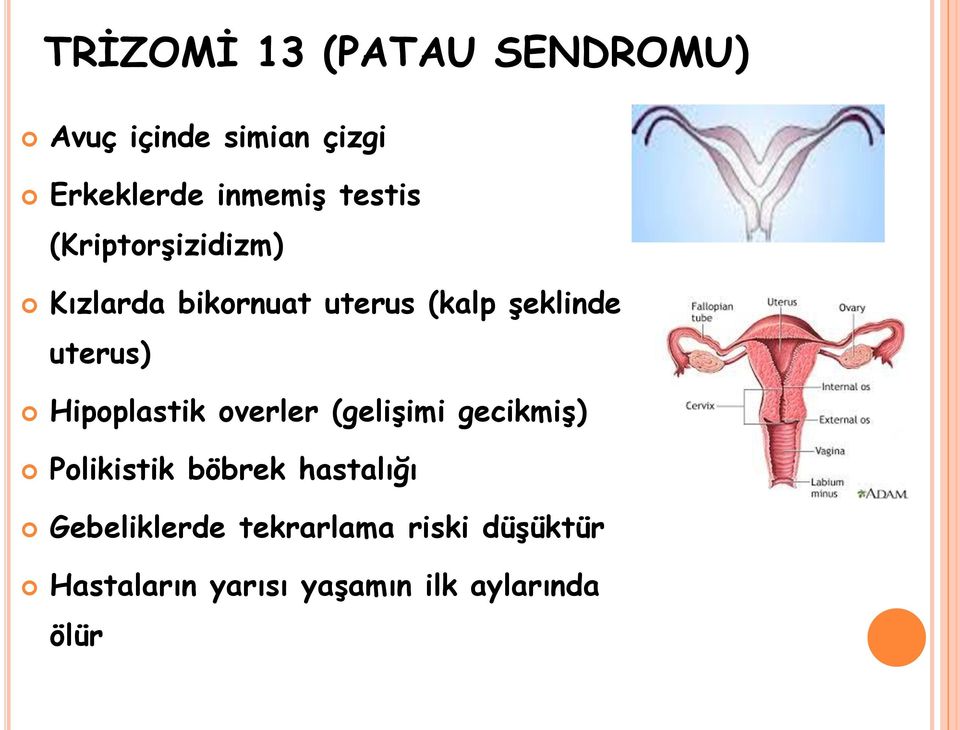 Hipoplastik overler (gelişimi gecikmiş) Polikistik böbrek hastalığı