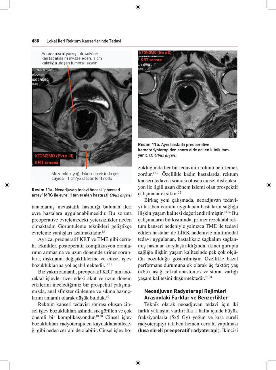 Bu soruna preoperative evrelemedeki yetersizlikler neden olmaktadır. Görüntüleme teknikleri geliştikçe evreleme yanlışları azalmaktadır.