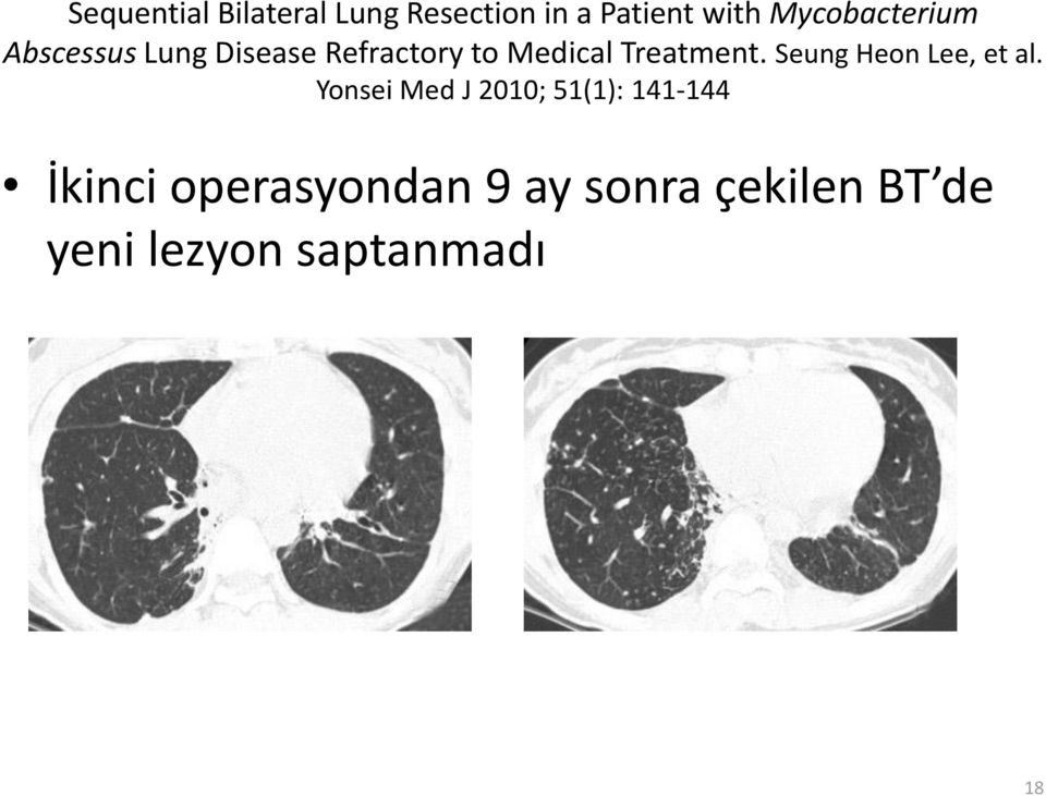 Treatment. Seung Heon Lee, et al.