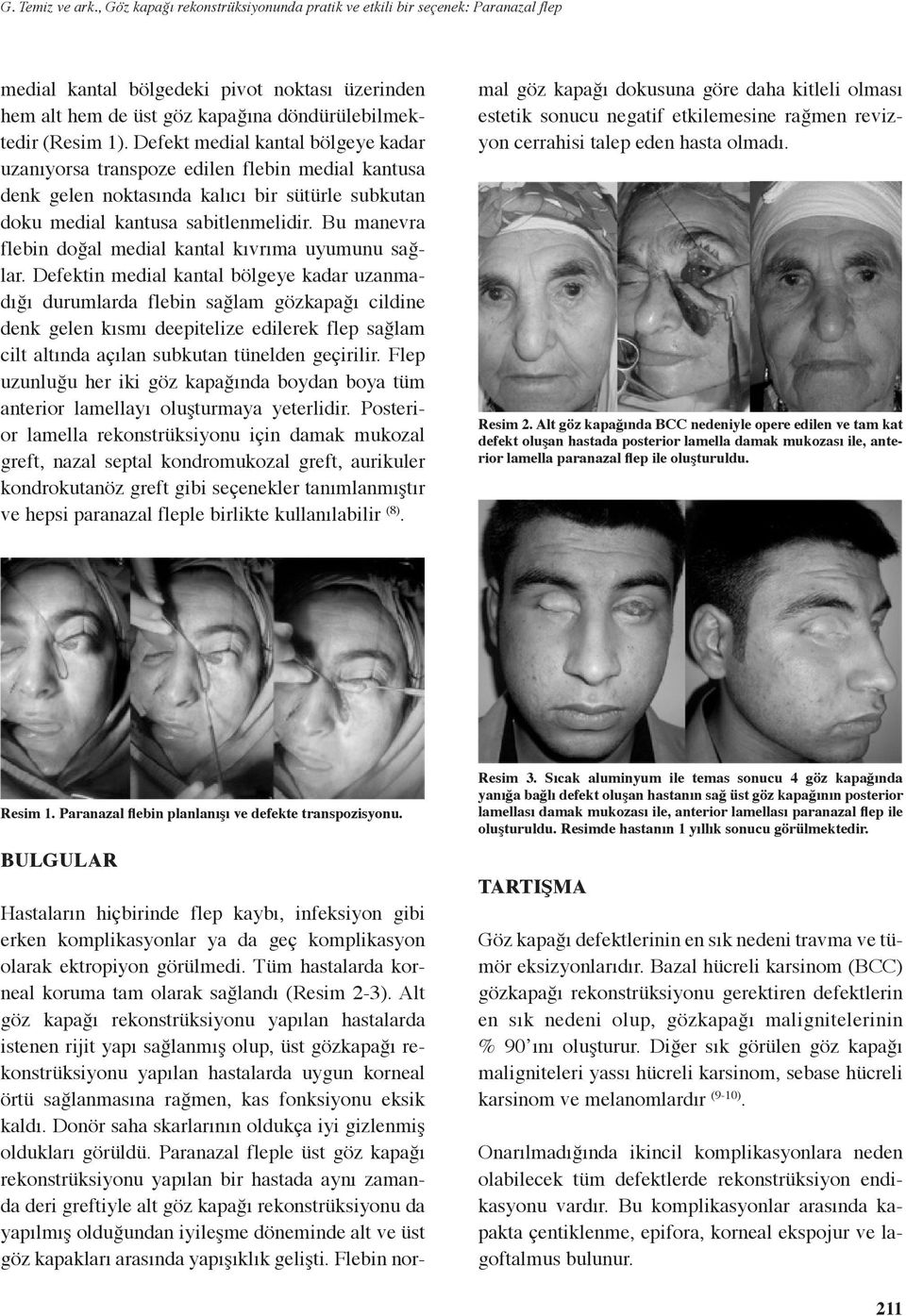 Defekt medial kantal bölgeye kadar uzanıyorsa transpoze edilen flebin medial kantusa denk gelen noktasında kalıcı bir sütürle subkutan doku medial kantusa sabitlenmelidir.