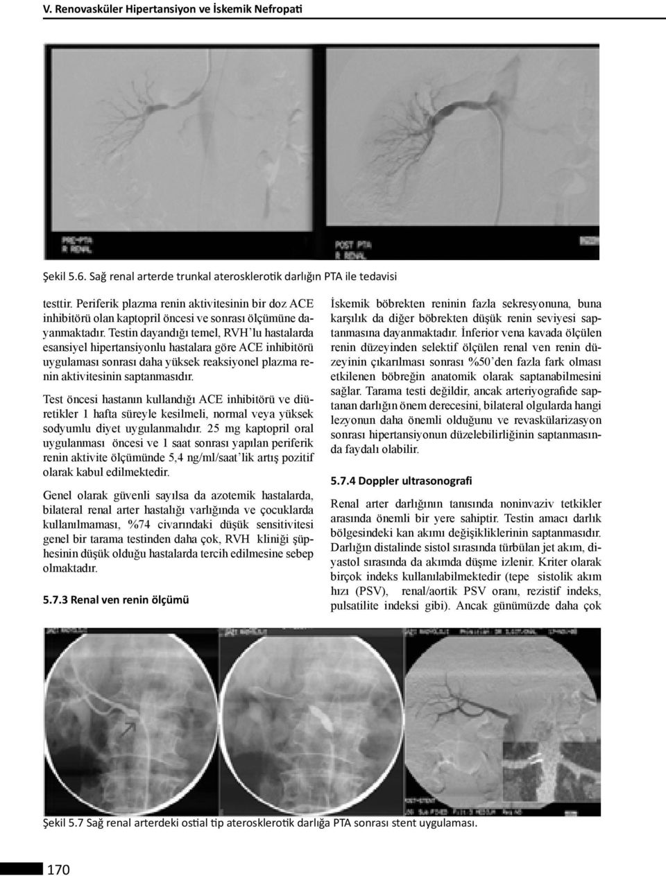 Testin dayandığı temel, RVH lu hastalarda esansiyel hipertansiyonlu hastalara göre ACE inhibitörü uygulaması sonrası daha yüksek reaksiyonel plazma renin aktivitesinin saptanmasıdır.