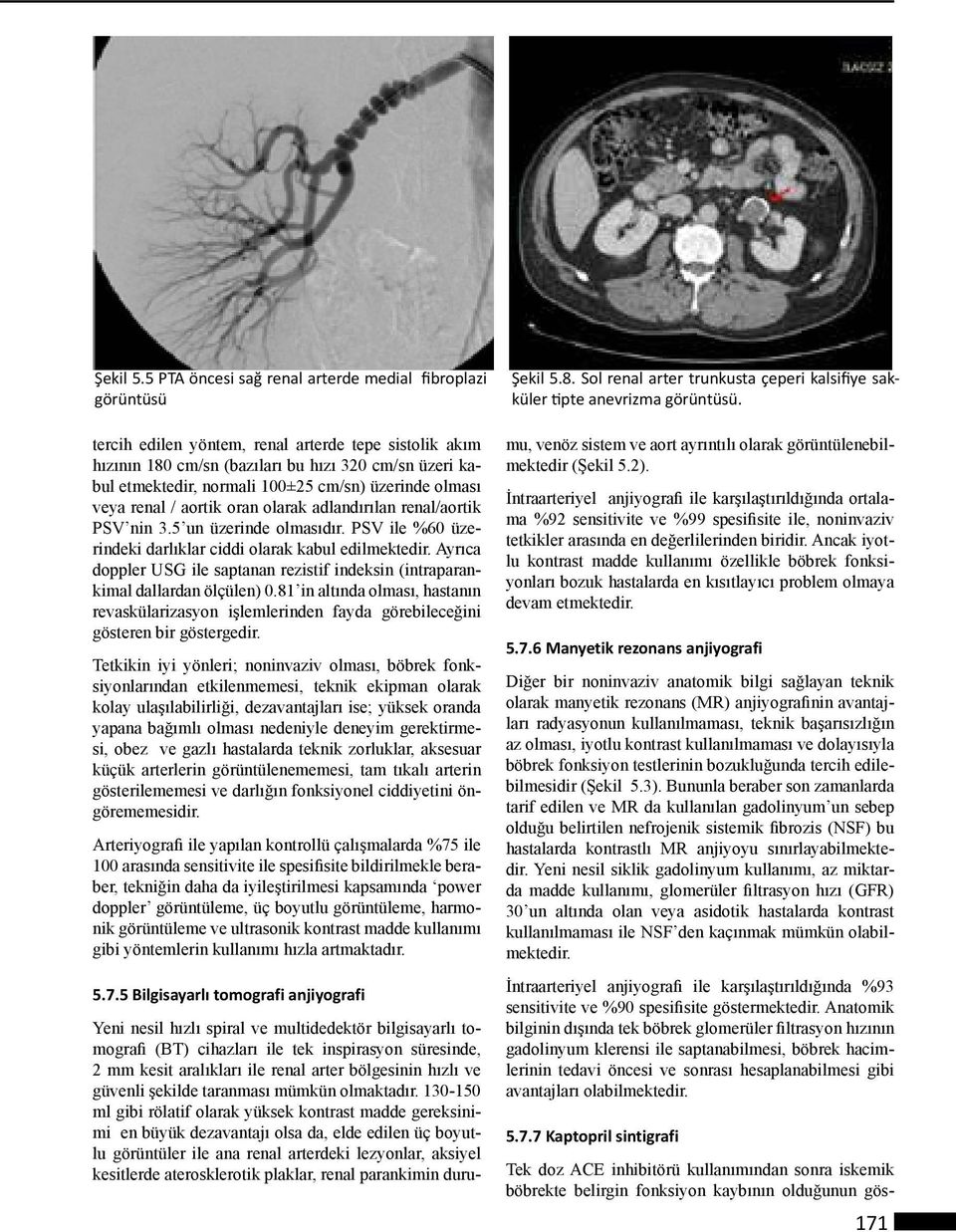 cm/sn) üzerinde olması veya renal / aortik oran olarak adlandırılan renal/aortik PSV nin 3.5 un üzerinde olmasıdır. PSV ile %60 üzerindeki darlıklar ciddi olarak kabul edilmektedir.