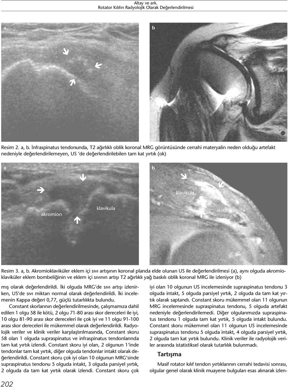 klavikula akromion klavikula akromion Resim 3. a, b.