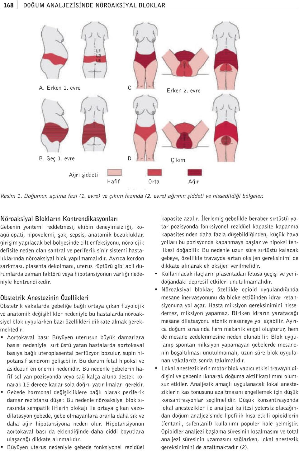 Nöroaksiyal Bloklar n Kontrendikasyonlar Gebenin yöntemi reddetmesi, ekibin deneyimsizli i, koagülopati, hipovolemi, flok, sepsis, anatomik bozukluklar, giriflim yap lacak bel bölgesinde cilt