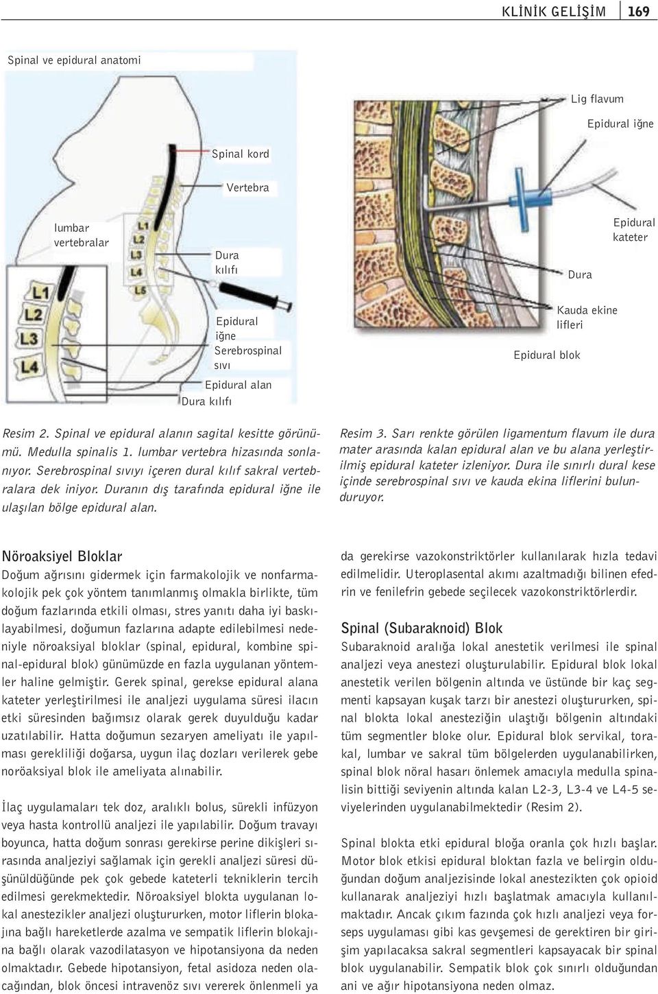 Duran n d fl taraf nda epidural i ne ile ulafl lan bölge epidural alan. Epidural blok Kauda ekine lifleri Resim 3.