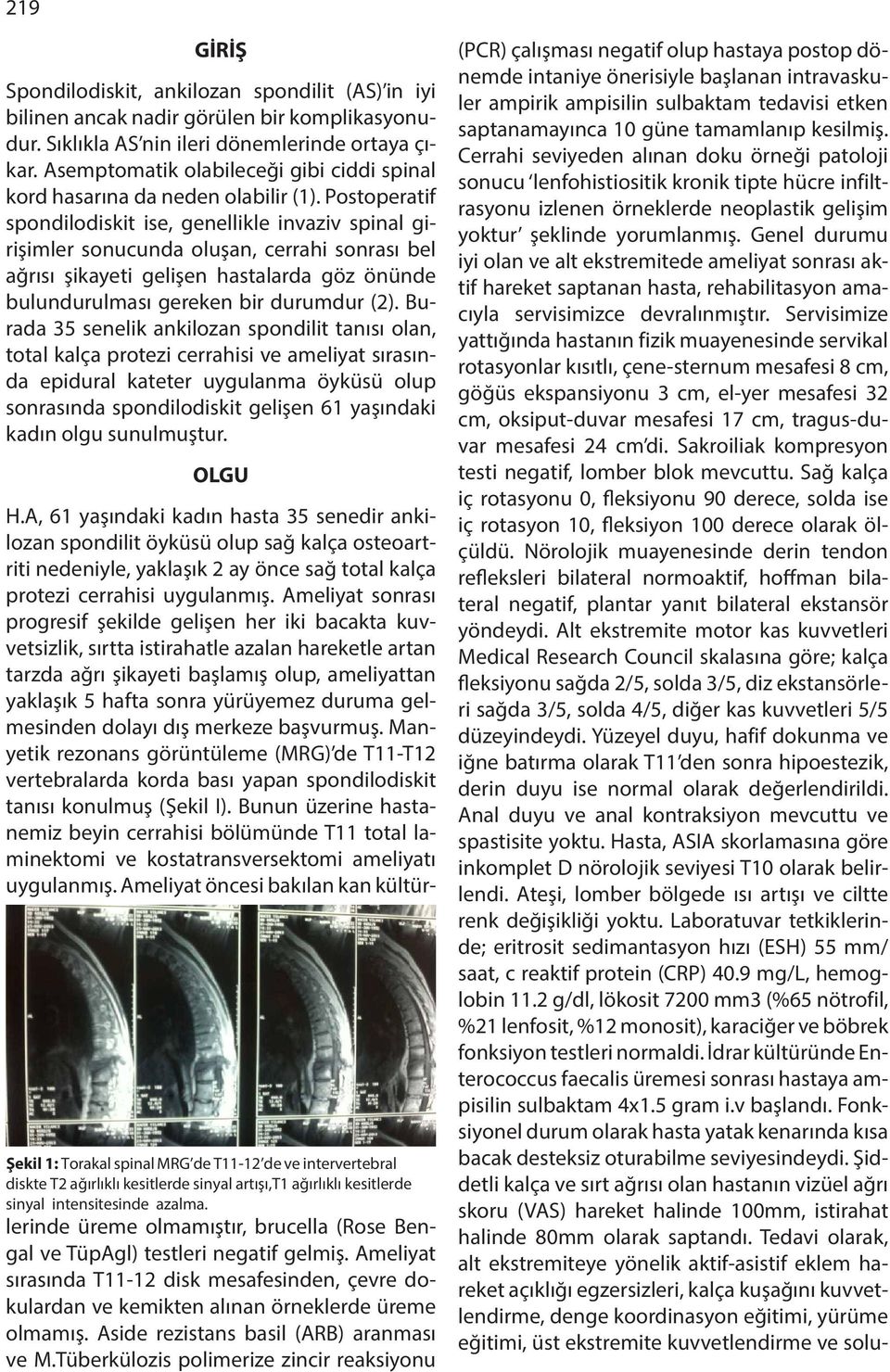 Postoperatif spondilodiskit ise, genellikle invaziv spinal girişimler sonucunda oluşan, cerrahi sonrası bel ağrısı şikayeti gelişen hastalarda göz önünde bulundurulması gereken bir durumdur (2).