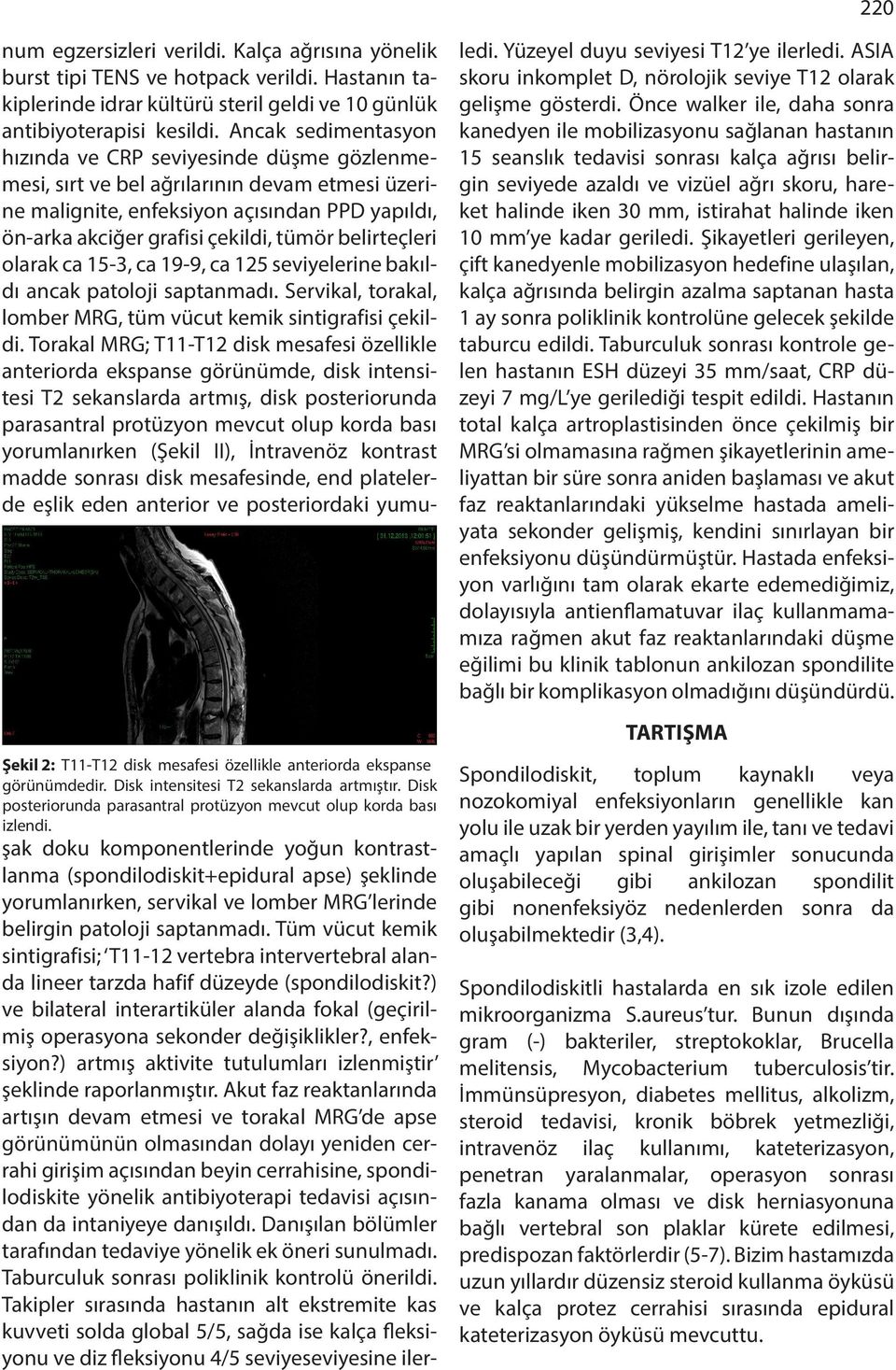 belirteçleri olarak ca 15-3, ca 19-9, ca 125 seviyelerine bakıldı ancak patoloji saptanmadı. Servikal, torakal, lomber MRG, tüm vücut kemik sintigrafisi çekildi.