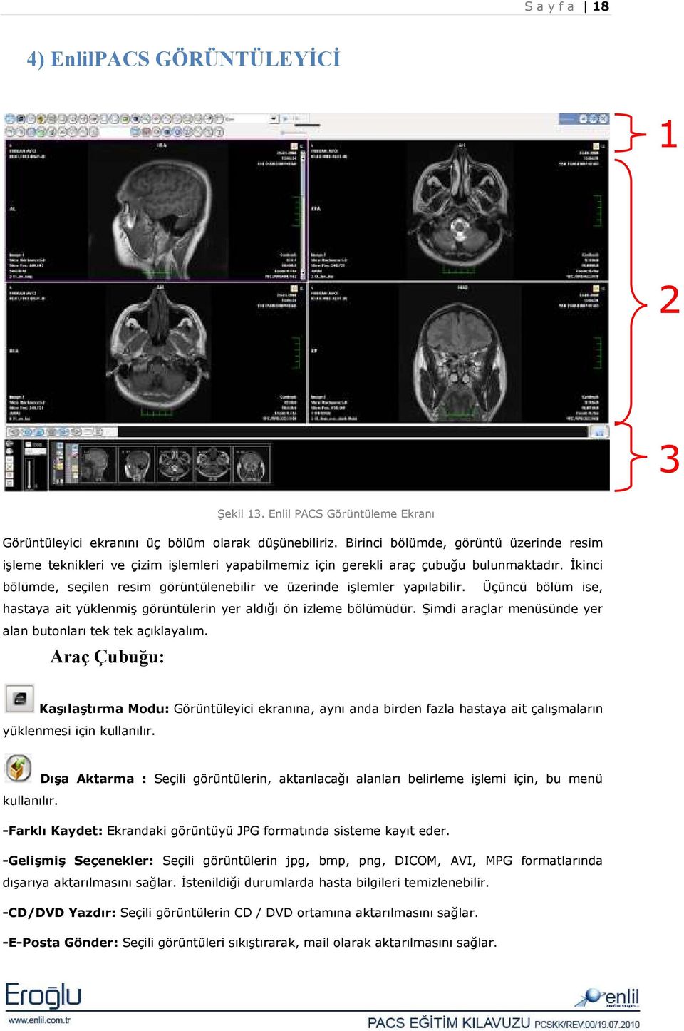 Đkinci bölümde, seçilen resim görüntülenebilir ve üzerinde işlemler yapılabilir. Üçüncü bölüm ise, hastaya ait yüklenmiş görüntülerin yer aldığı ön izleme bölümüdür.