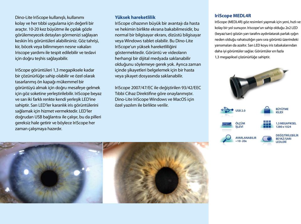 Göz tahrişi, kir, böcek veya bilinmeyen nesne vakaları Iriscope yardımı ile tespit edilebilir ve tedavi için doğru teşhis sağlayabilir.