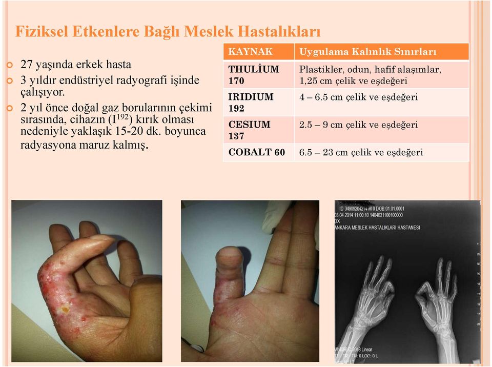 boyunca radyasyona maruz kalmış.