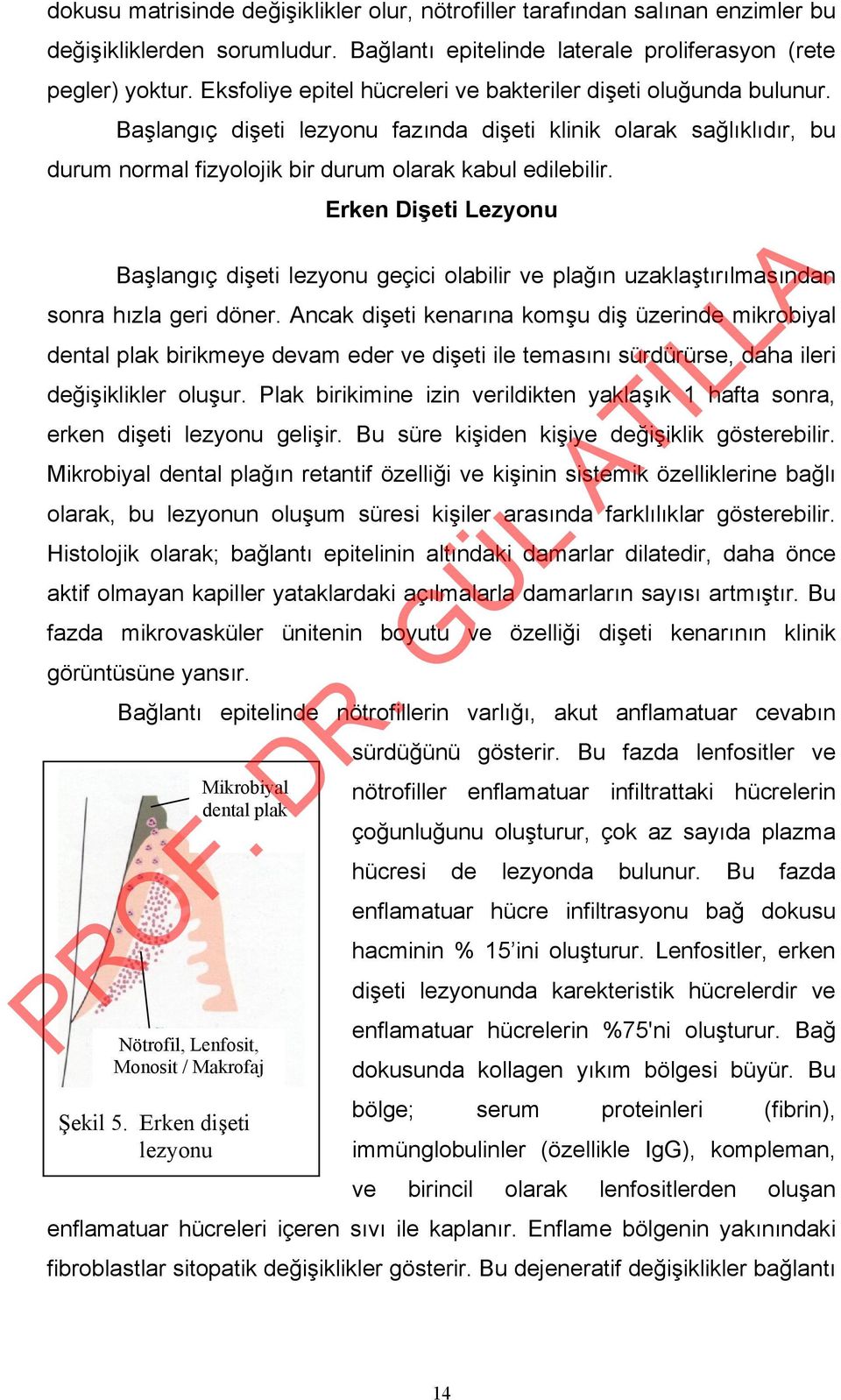 Erken Dişeti Lezyonu Başlangıç dişeti lezyonu geçici olabilir ve plağın uzaklaştırılmasından sonra hızla geri döner.