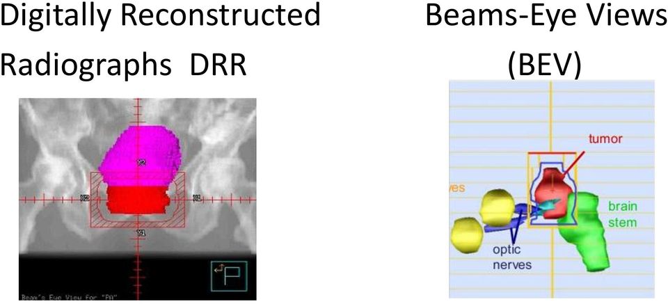 Radiographs DRR