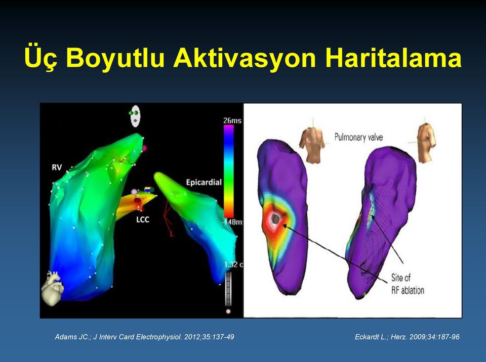 ; J Interv Card Electrophysiol.