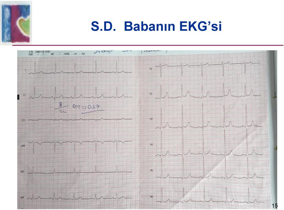 EKG si 15