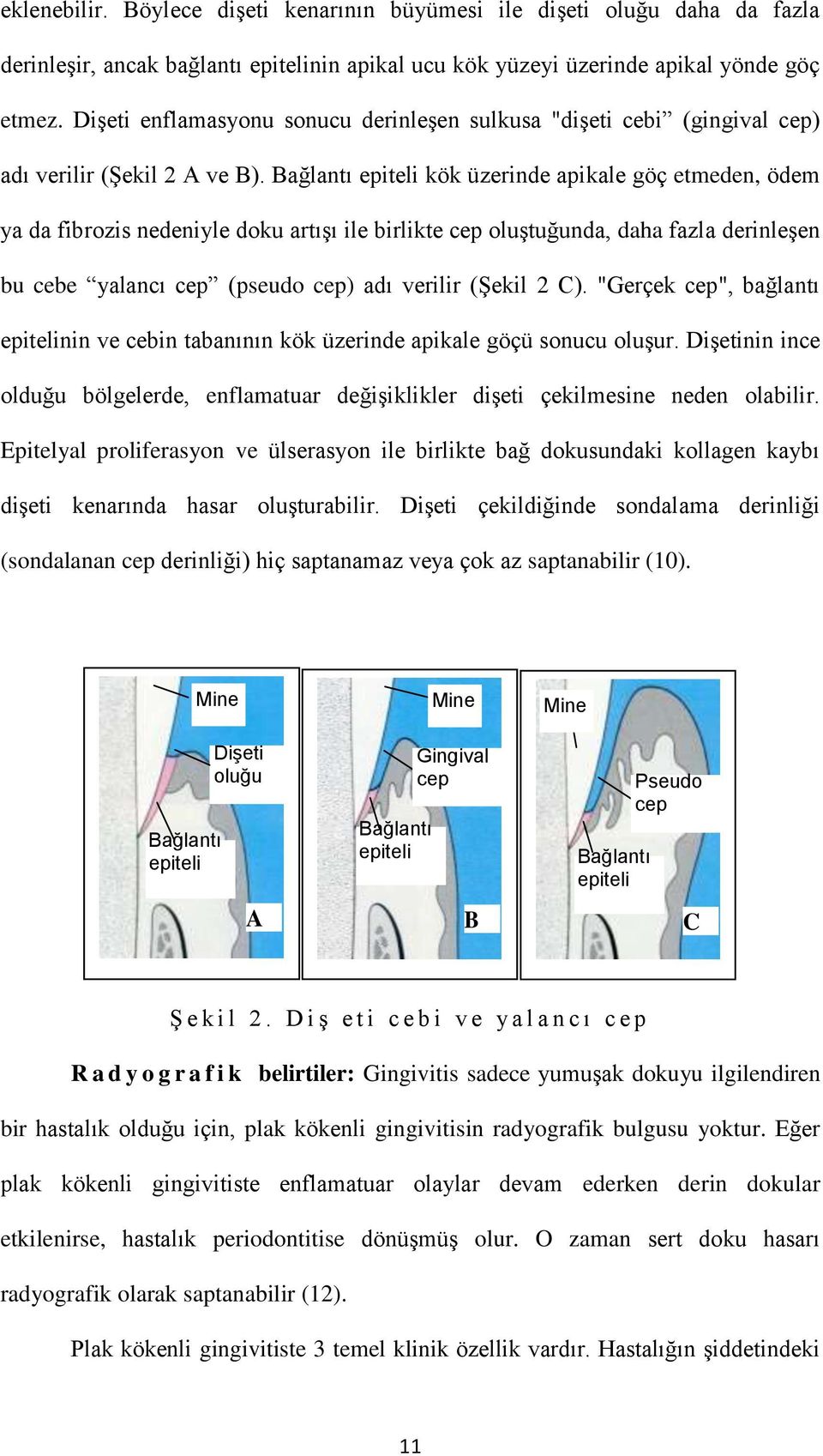 Bağlantı epiteli kök üzerinde apikale göç etmeden, ödem ya da fibrozis nedeniyle doku artışı ile birlikte cep oluştuğunda, daha fazla derinleşen bu cebe yalancı cep (pseudo cep) adı verilir (Şekil 2