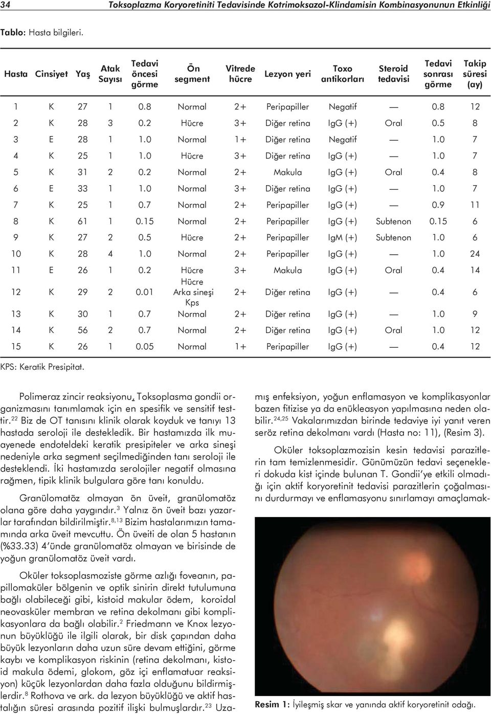 8 Normal 2+ Peripapiller Negatif 0.8 12 2 K 28 3 0.2 Hücre 3+ Diğer retina IgG (+) Oral 0.5 8 3 E 28 1 1.0 Normal 1+ Diğer retina Negatif 1.0 7 4 K 25 1 1.0 Hücre 3+ Diğer retina IgG (+) 1.