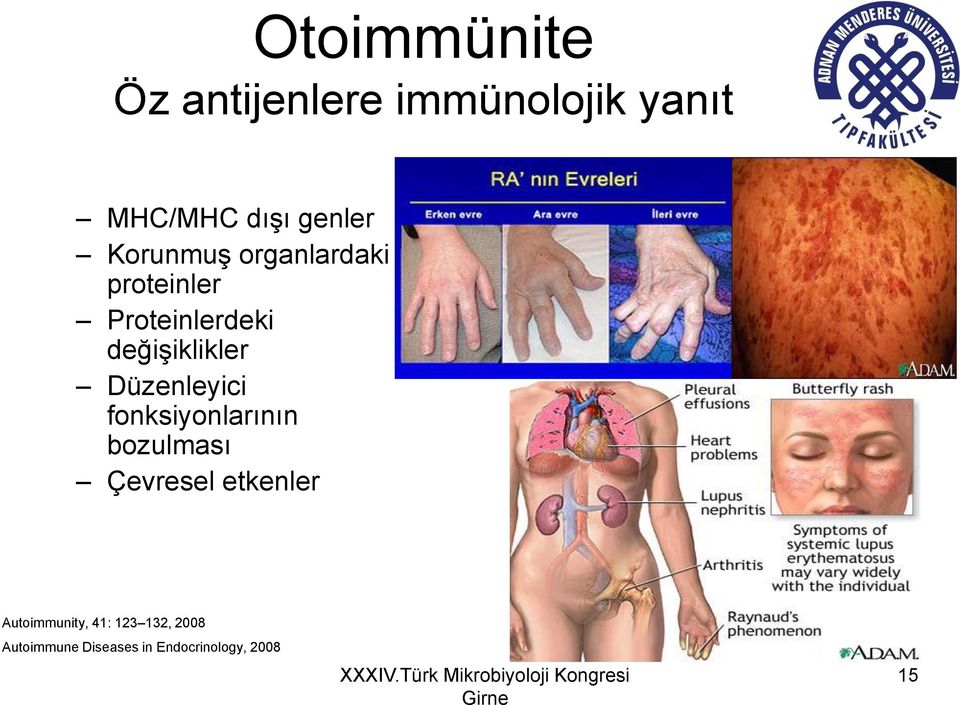 Düzenleyici fonksiyonlarının bozulması Çevresel etkenler