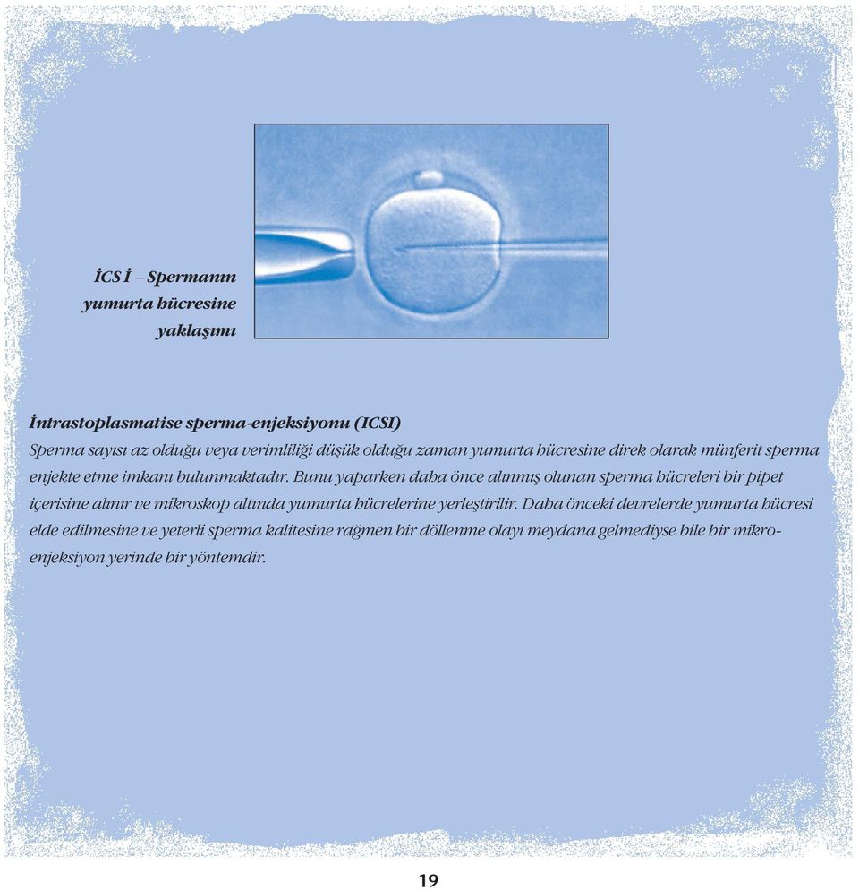 Bunu yaparken daha önce alınmış olunan sperma hücreleri bir pipet içerisine alınır ve mikroskop altında yumurta hücrelerine yerleştirilir.