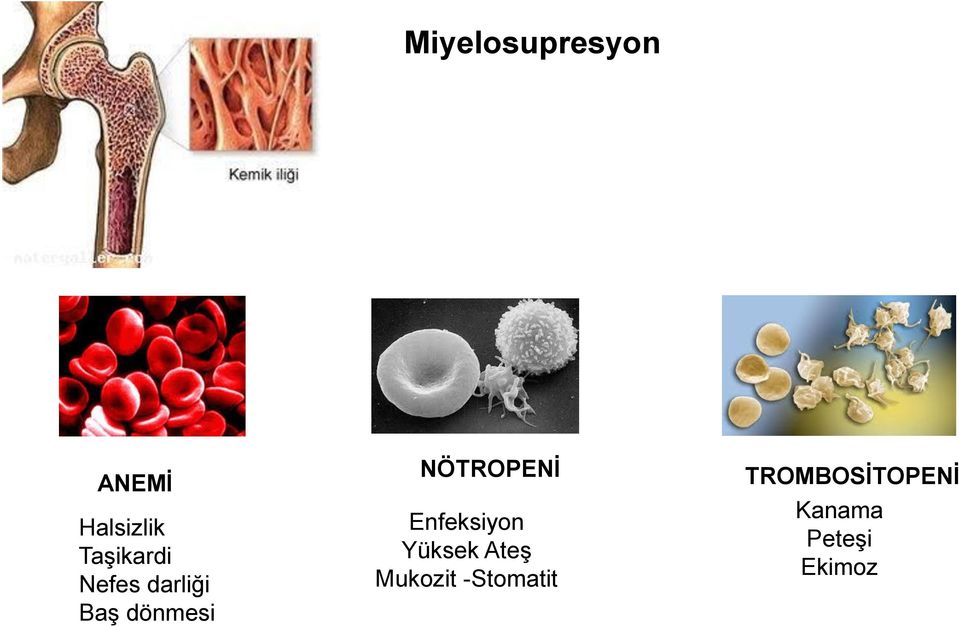 NÖTROPENİ Enfeksiyon Yüksek Ateş