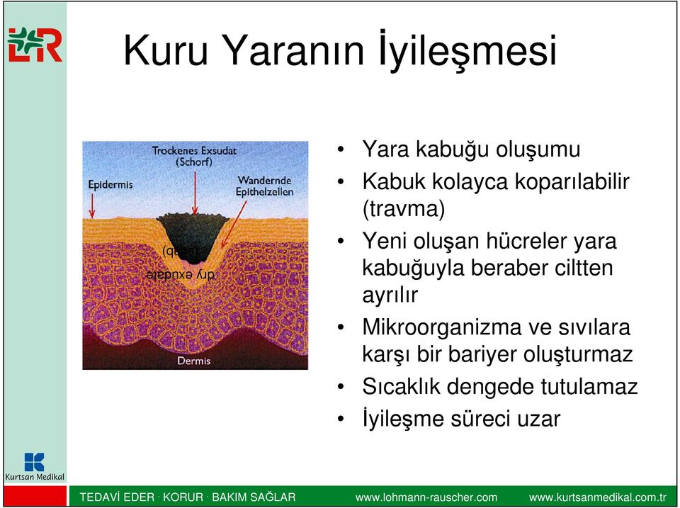 kabuğuyla beraber ciltten ayrılır Mikroorganizma ve sıvılara