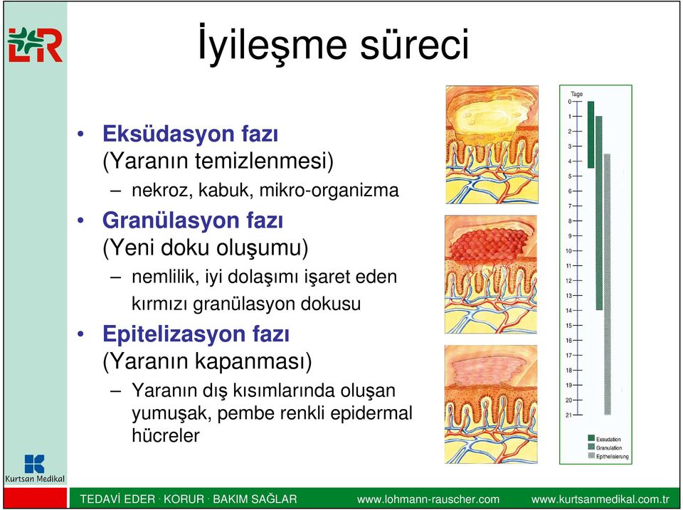 dolaşımı işaret eden kırmızı granülasyon dokusu Epitelizasyon fazı