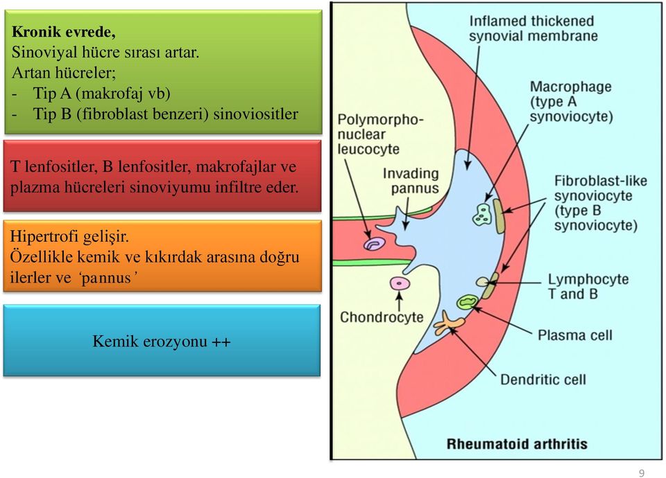 sinoviositler T lenfositler, B lenfositler, makrofajlar ve plazma hücreleri