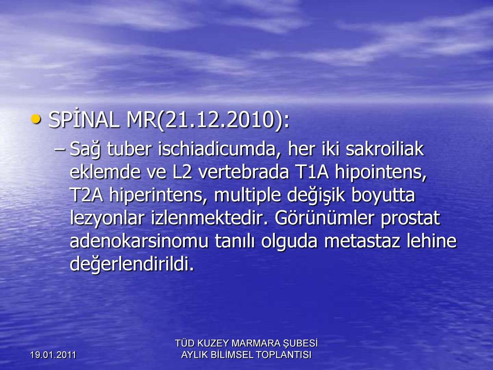 L2 vertebrada T1A hipointens, T2A hiperintens, multiple değişik