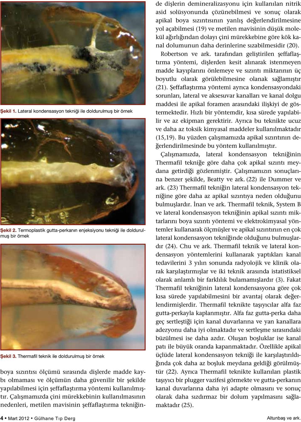 Çalışmamızda çini mürekkebinin kullanılmasının nedenleri, metilen mavisinin şeffaflaştırma tekniğinde dişlerin demineralizasyonu için kullanılan nitrik asid solüsyonunda çözünebilmesi ve sonuç olarak