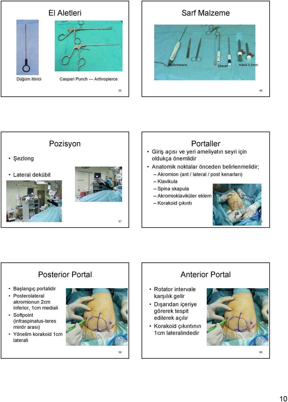 Akromioklaviküler eklem Korakoid çıkıntı 57 58 Başlangıç portalidir Posterolateral akromionun 2cm inferior, 1cm mediali Softpoint (infraspinatus-teres minör arası)