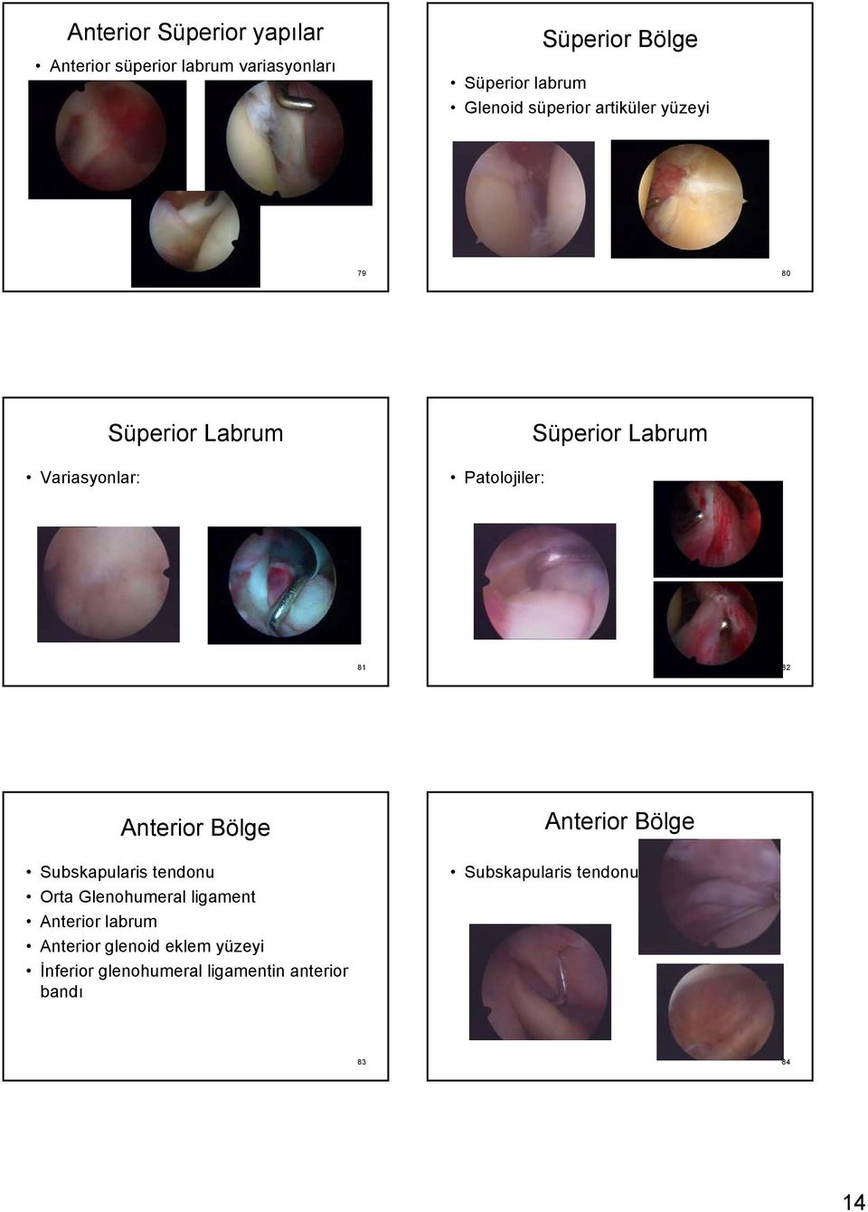 81 82 Anterior Bölge Subskapularis tendonu Orta Glenohumeral ligament Anterior labrum Anterior