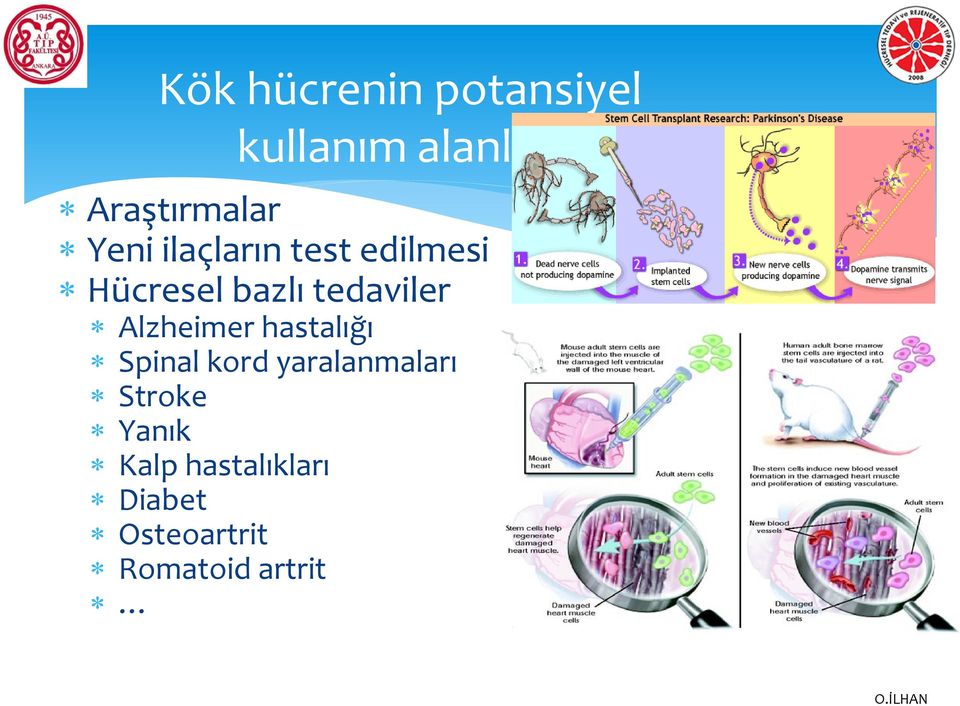 Alzheimer hastalığı Spinal kord yaralanmaları Stroke