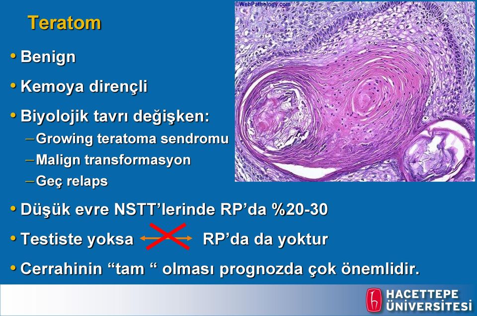 relaps DüĢük evre NSTT lerinde RP da %20-30 Testiste