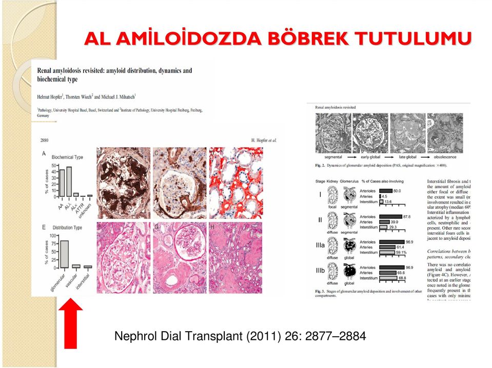 TUTULUMU Nephrol Dial