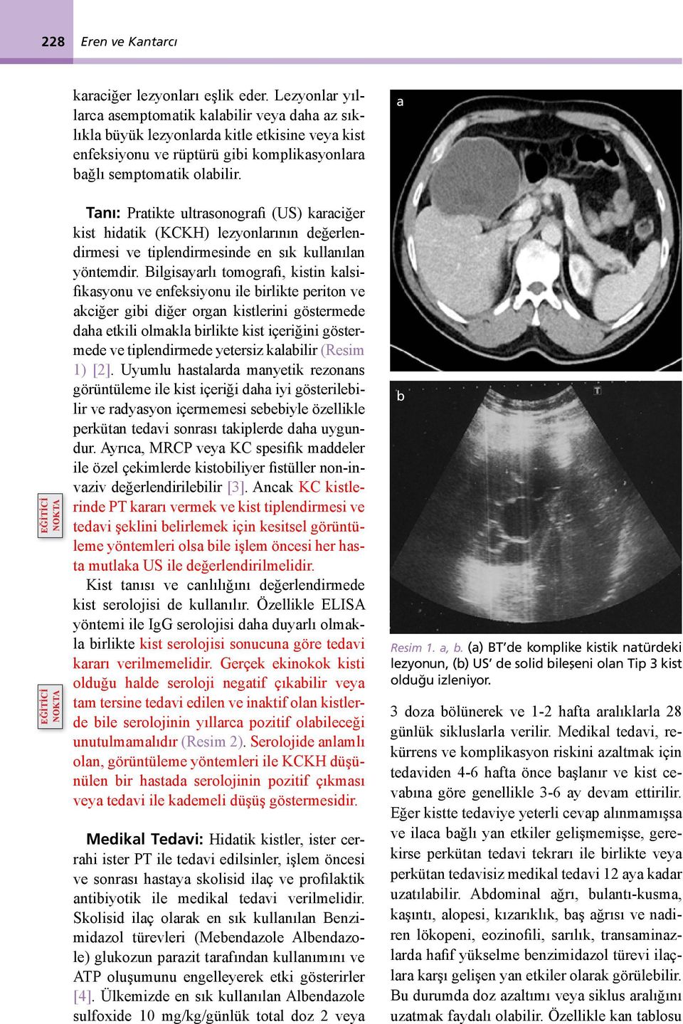 a EĞİTİCİ NOKTA EĞİTİCİ NOKTA Tanı: Pratikte ultrasonografi (US) karaciğer kist hidatik (KCKH) lezyonlarının değerlendirmesi ve tiplendirmesinde en sık kullanılan yöntemdir.