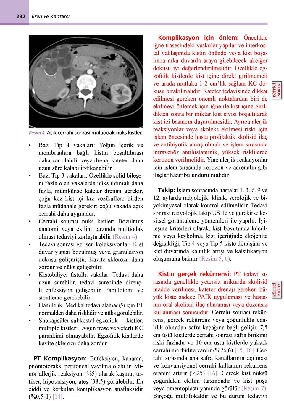 Bazı Tip 3 vakaları: Özellikle solid bileşeni fazla olan vakalarda nüks ihtimali daha fazla, mümkünse kateter drenajı gerekir, çoğu kez kist içi kız veziküllere birden fazla müdahale gerekir; çoğu