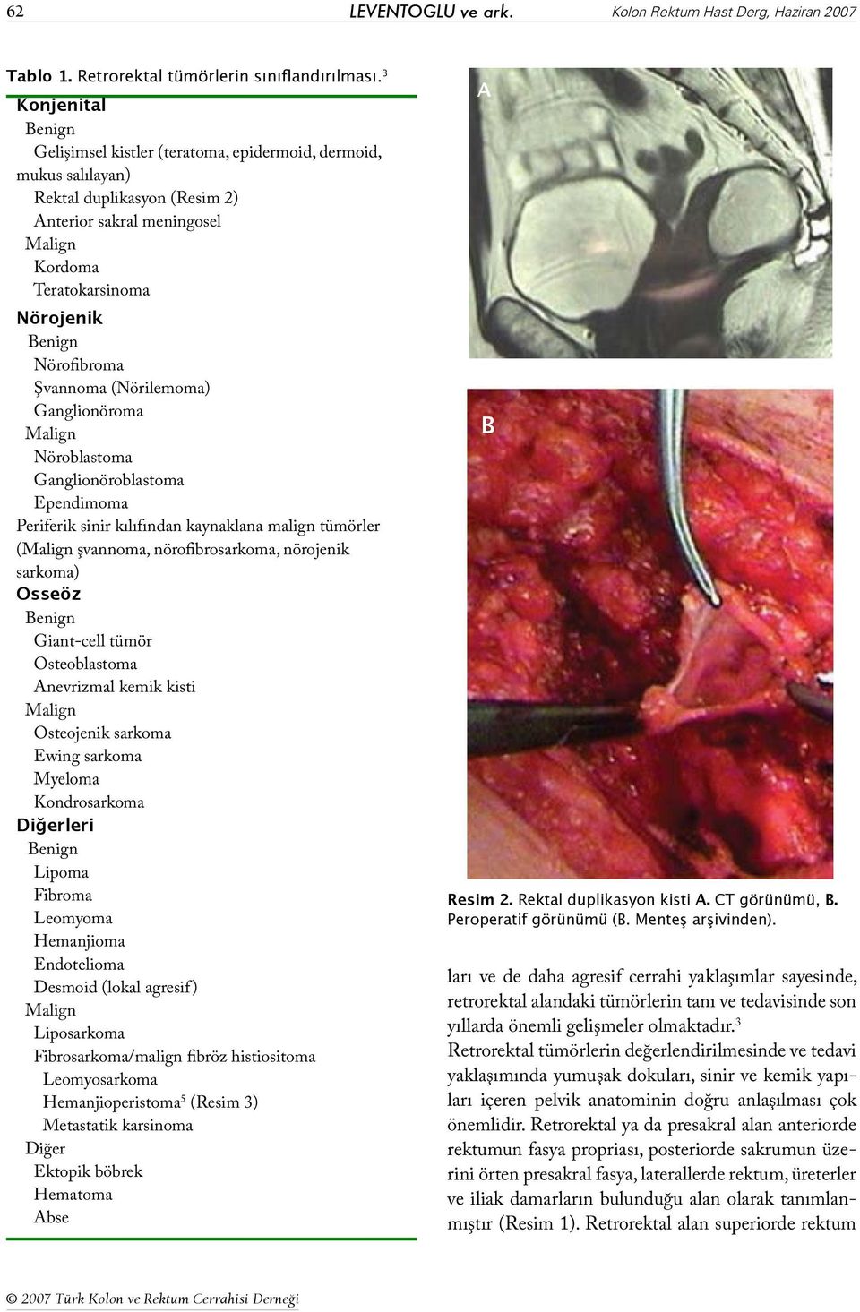 Nörofibroma Şvannoma (Nörilemoma) Ganglionöroma Malign Nöroblastoma Ganglionöroblastoma Ependimoma Periferik sinir kılıfından kaynaklana malign tümörler (Malign şvannoma, nörofibrosarkoma, nörojenik