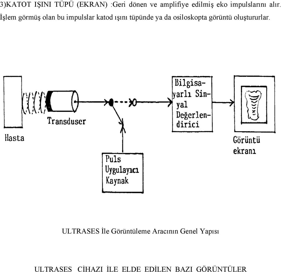 İşlem görmüş olan bu impulslar katod ışını tüpünde ya da