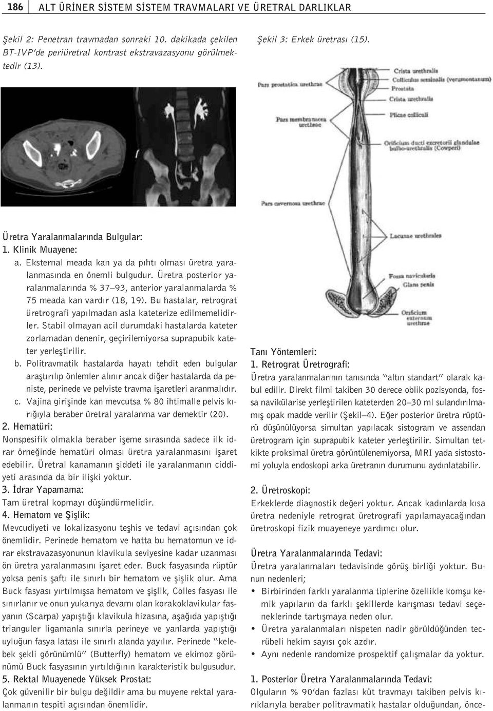 dakikada çekilen BT-IVP de periüretral kontrast ekstravazasyonu görülmektedir (13). fiekil 3: Erkek üretras (15). Üretra Yaralanmalar nda Bulgular: 1. Klinik Muayene: a.