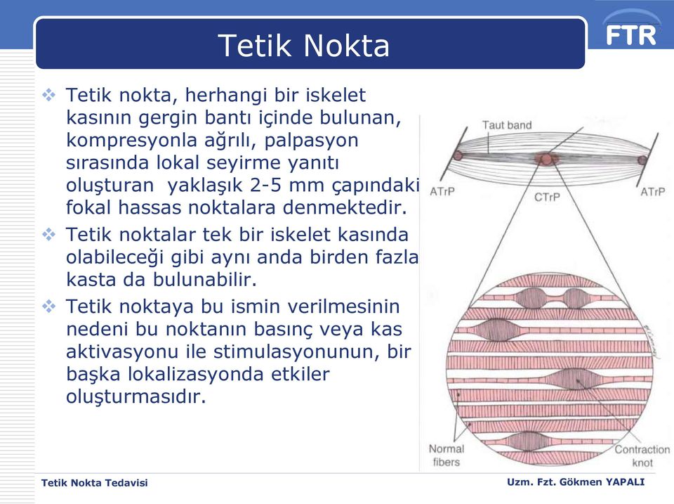 Tetik noktalar tek bir iskelet kasında olabileceği gibi aynı anda birden fazla kasta da bulunabilir.