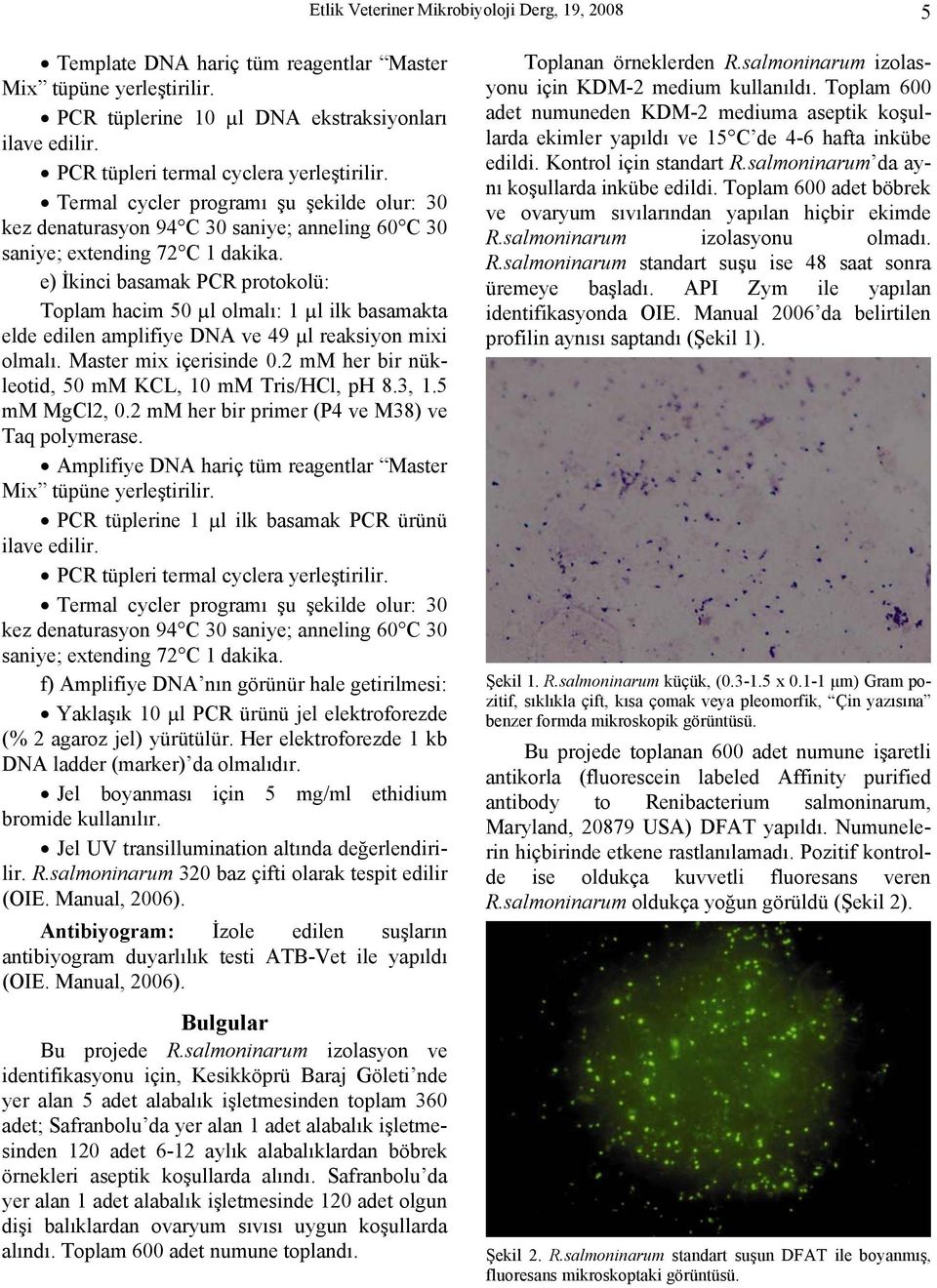 e) İkinci basamak PCR protokolü: Toplam hacim 50 µl olmalı: 1 µl ilk basamakta elde edilen amplifiye DNA ve 49 µl reaksiyon mixi olmalı. Master mix içerisinde 0.