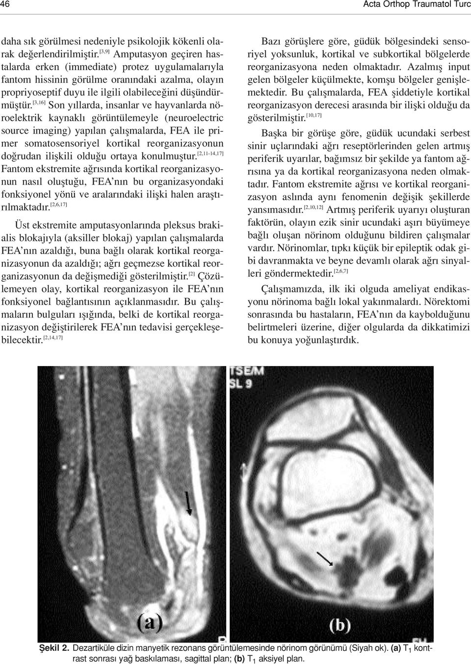 [3,16] Son y llarda, insanlar ve hayvanlarda nöroelektrik kaynakl görüntülemeyle (neuroelectric source imaging) yap lan çal flmalarda, FEA ile primer somatosensoriyel kortikal reorganizasyonun do