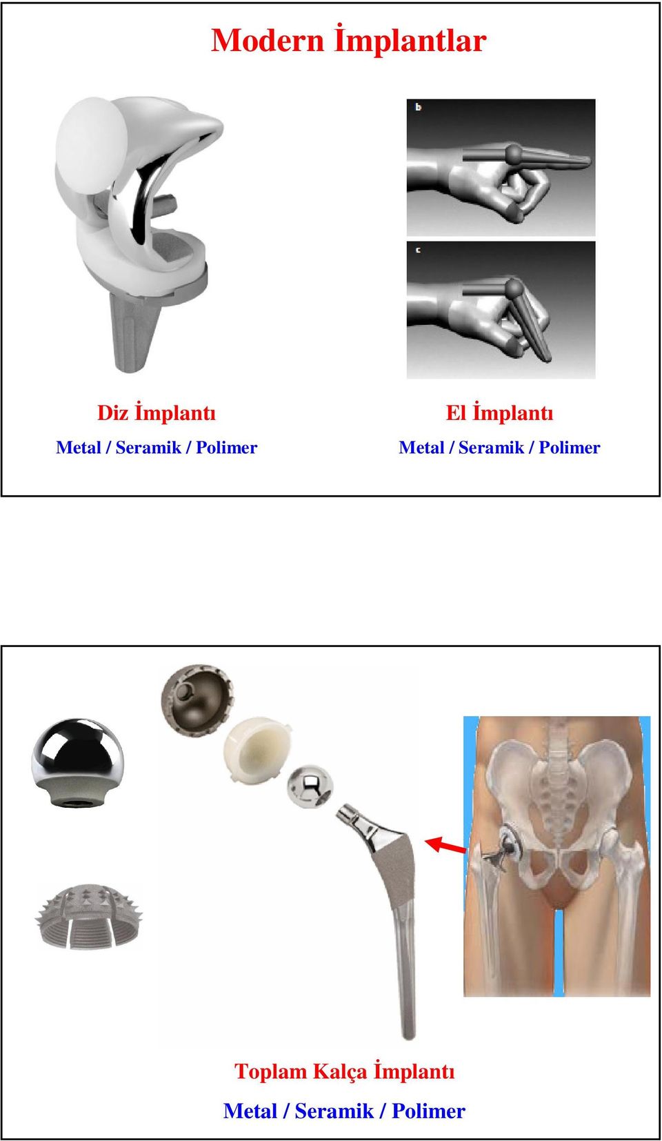 İmplantı Metal / Seramik / Polimer