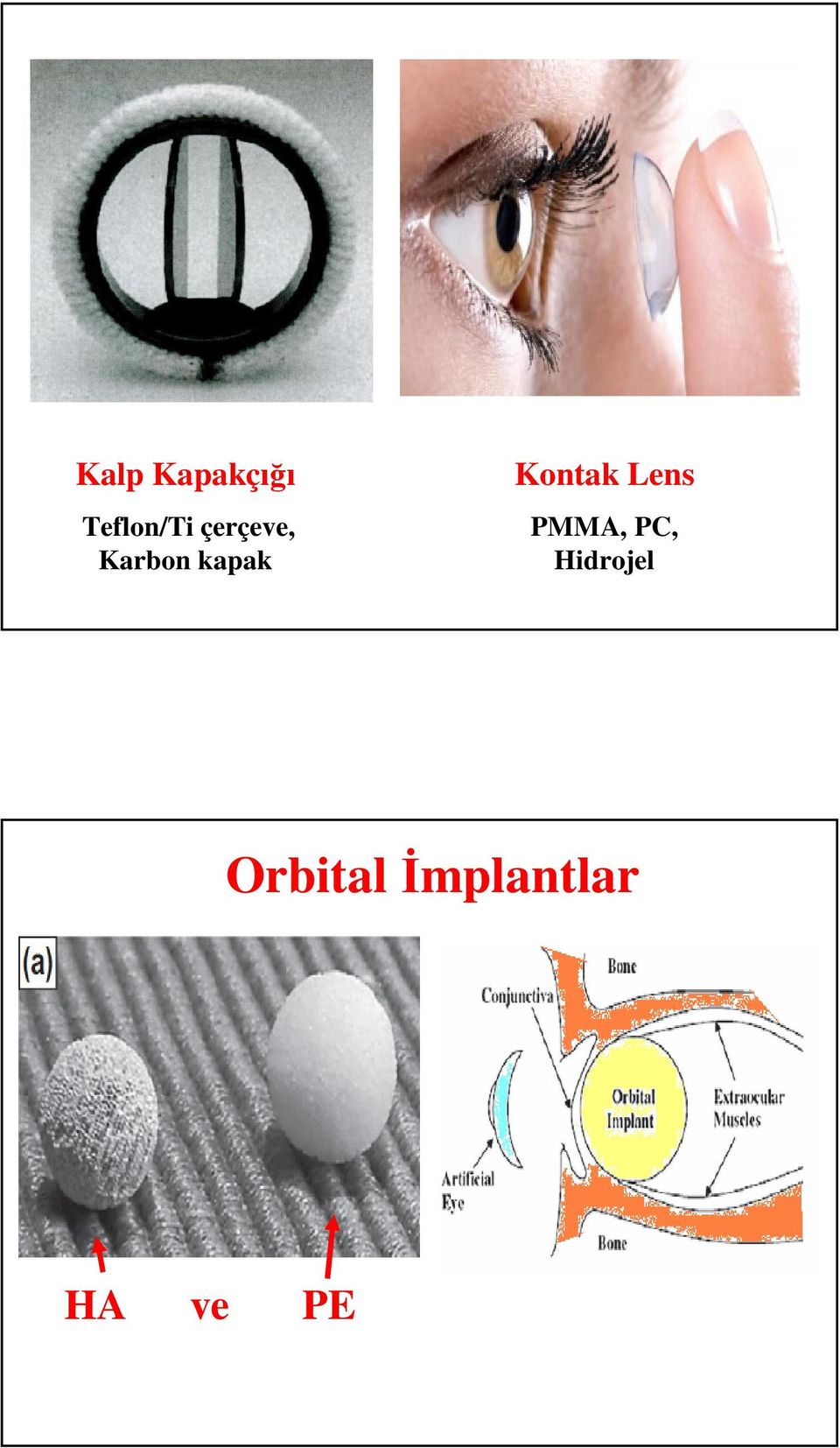 Kontak Lens PMMA, PC,