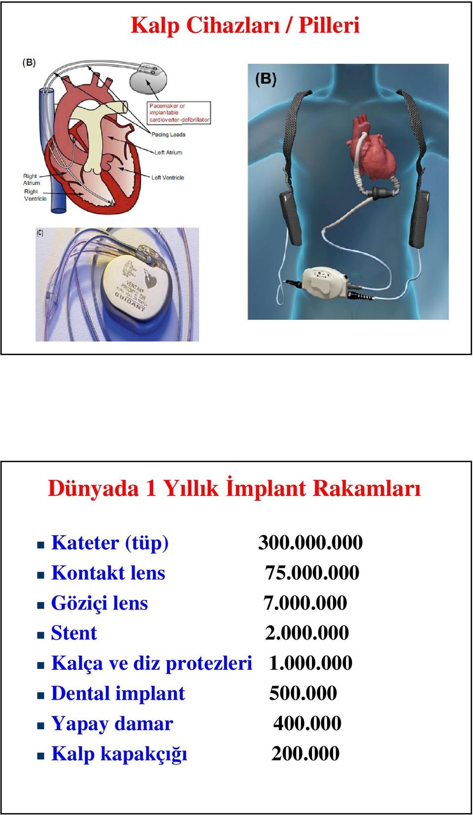 000.000 Stent 2.000.000 Kalça ve diz protezleri 1.000.000 Dental implant 500.