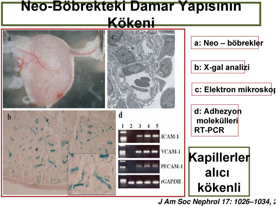 mikroskop d: Adhezyon molekülleri RT-PCR