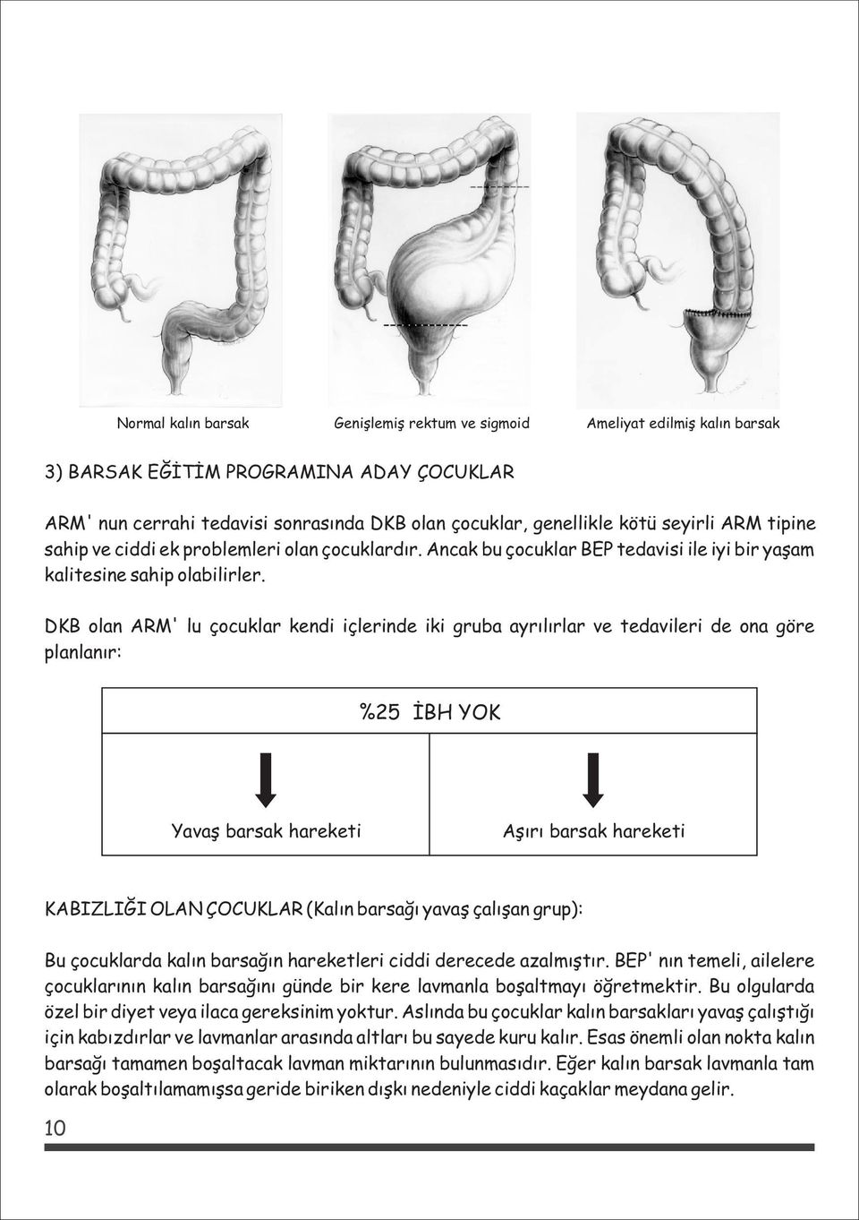 DKB olan ARM' lu çocuklar kendi içlerinde iki gruba ayrýlýrlar ve tedavileri de ona göre planlanýr: %25 ÝBH YOK Yavaþ barsak hareketi Aþýrý barsak hareketi KABIZLIÐI OLAN ÇOCUKLAR (Kalýn barsaðý