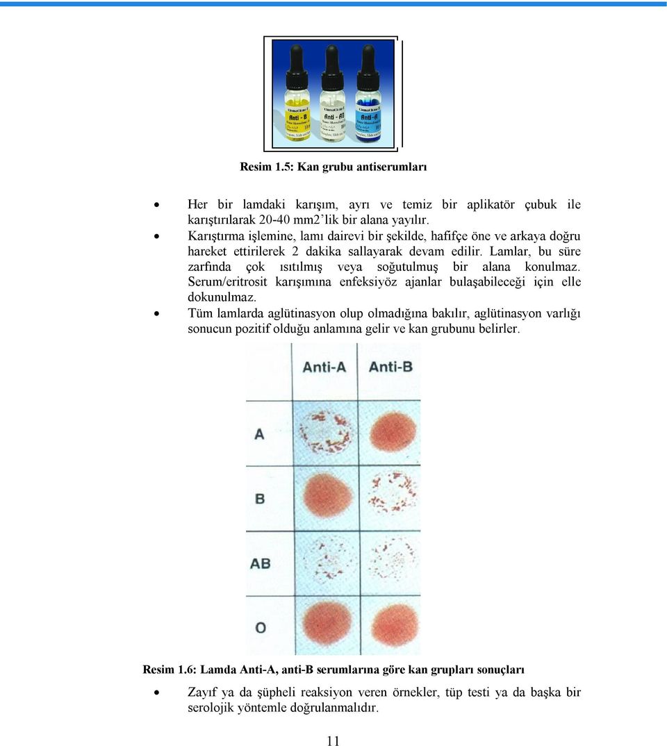 Lamlar, bu süre zarfında çok ısıtılmış veya soğutulmuş bir alana konulmaz. Serum/eritrosit karışımına enfeksiyöz ajanlar bulaşabileceği için elle dokunulmaz.